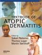 Textbook Of Atopic Dermatitis - Preview