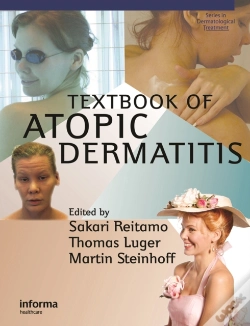 Capa do artigo Textbook Of Atopic Dermatitis
