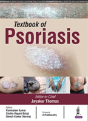 Textbook Of Psoriasis - Preview