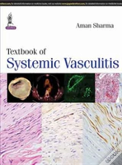 Capa do artigo Textbook Of Systemic Vasculitis