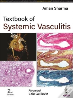Capa do artigo Textbook Of Systemic Vasculitis