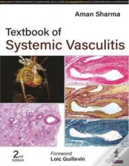 Textbook Of Systemic Vasculitis