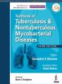 Textbook Of Tuberculosis And Nontuberculousis Mycobacterial Diseases - Preview