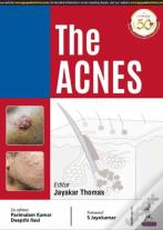 The Acnes