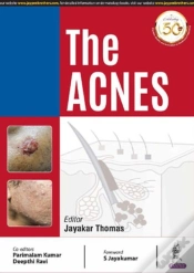 Capa do artigo The Acnes