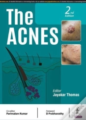 Capa do artigo The Acnes