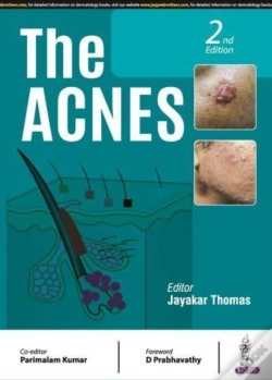 Capa do artigo The Acnes