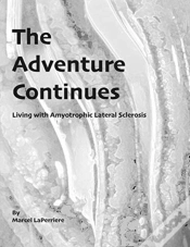 Capa do artigo The Adventure Continues: Living With Amy