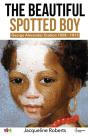 The Beautiful Spotted Boy - Preview