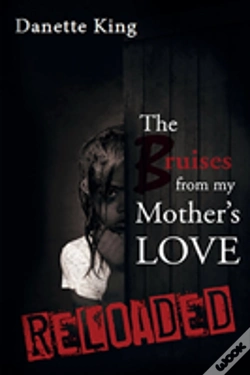 Capa do artigo The Bruises From My Mother'S Love