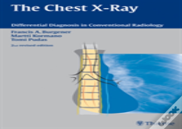 The Chest X-Ray