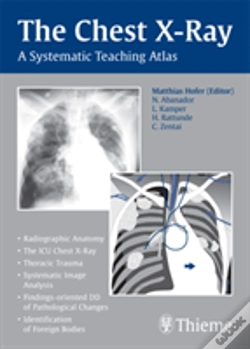 Capa do artigo The Chest X-Ray