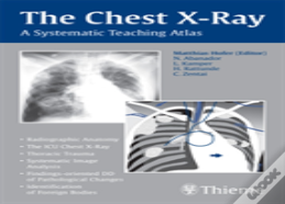 The Chest X-Ray