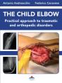 The Child Elbow - Preview