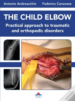 Capa do artigo The Child Elbow