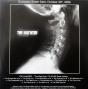 The Dead Eye - CD - Preview