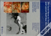 The Facial Nerve In Temporal Bone And Lateral Skull Base