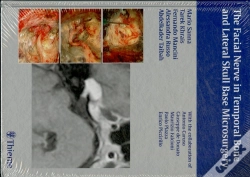 Capa do artigo The Facial Nerve In Temporal Bone And Lateral Skull Base