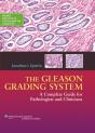 The Gleason Grading System - Preview