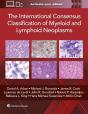 The International Consensus Classification Of Myeloid And Lymphoid Neoplasms - Preview