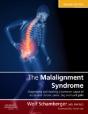 The Malalignment Syndrome - Preview