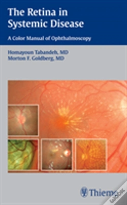 Capa do artigo The Retina In Systemic Disease