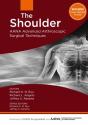 The Shoulder - Preview