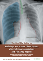 The Unofficial Guide To Radiology: 100 Practice Chest X Rays With Full Colour Annotations And Full X Ray Reports - Preview