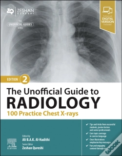 Capa do artigo The Unofficial Guide To Radiology: 100 Practice Chest X-Rays