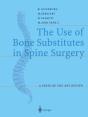 The Use Of Bone Substitutes In Spine Surgery - Preview