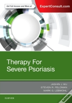 Capa do artigo Therapy For Severe Psoriasis