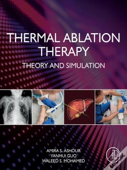 Capa do artigo Thermal Ablation Therapy