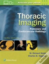 Thoracic Imaging 3e