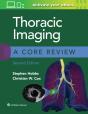 Thoracic Imaging: A Core Review - Preview