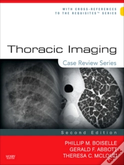 Capa do artigo Thoracic Imaging: Case Review Series