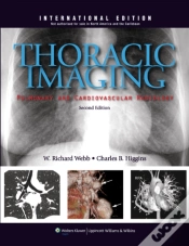 Capa do artigo Thoracic Imaging: Pulmonary And Cardiovascular Radiology