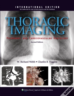 Capa do artigo Thoracic Imaging: Pulmonary And Cardiovascular Radiology