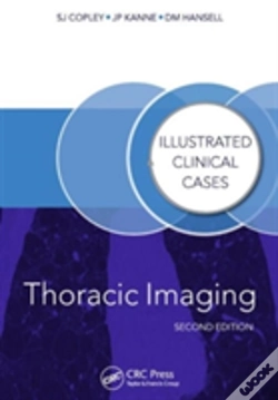 Capa do artigo Thoracic Imaging