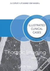 Thoracic Imaging