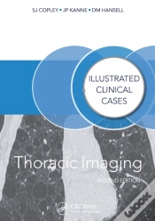 Capa do artigo Thoracic Imaging