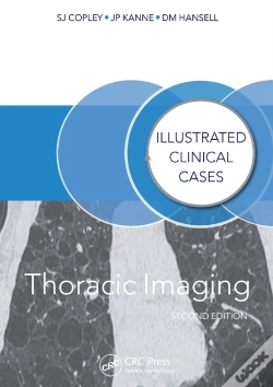 Capa do artigo Thoracic Imaging