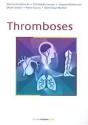 Thromboses - Preview