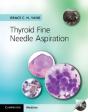Thyroid Fine Needle Aspiration With Cd Extra - Preview