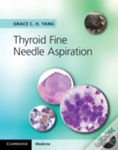 Thyroid Fine Needle Aspiration With Cd Extra