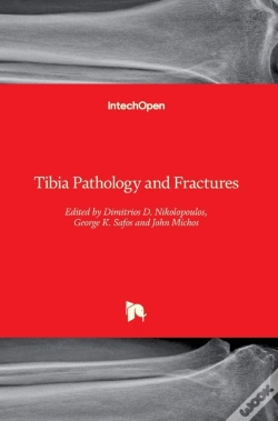 Capa do artigo Tibia Pathology And Fractures
