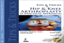 Tips And Tricks In Hip And Knee Arthroplasty