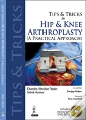 Tips And Tricks In Hip And Knee Arthroplasty