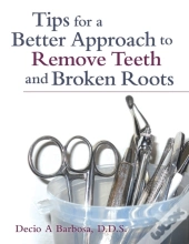 Tips For A Better Approach To Remove Teeth And Broken Roots