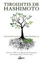 Tiroiditis De Hashimoto - Preview