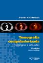 Tomografia Computadorizada - Preview